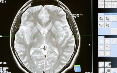 Can Alcohol Cause Permanent Brain Damage? What Science and Hope Both Say